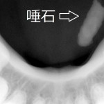 だせき2